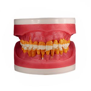Refil Cirurgia com Dentes de Perio AC025 - Pronew
