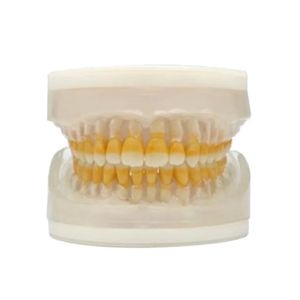 Refil Top Periodontia I AC104 - Pronew