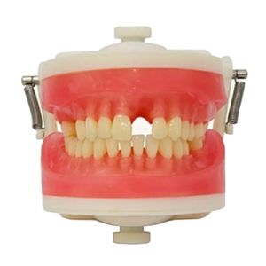 Manequim de Prótese Fixa PD104 - Pronew