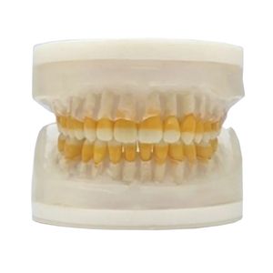 Refil Top Materiais Periodontia II AC105 - Pronew